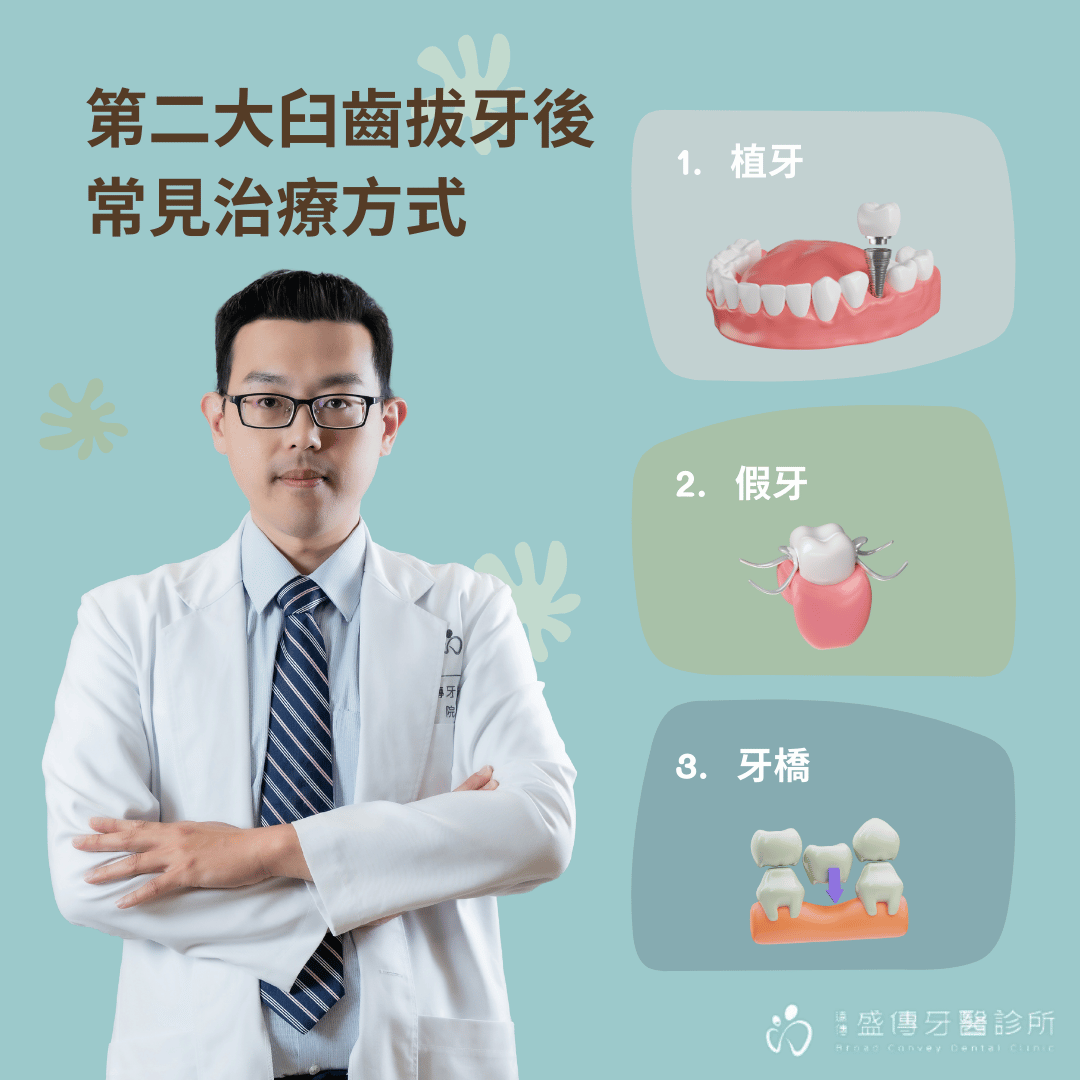 第二大臼齒拔掉一定要植牙嗎?拔牙多久是植牙最佳時間點? 1 第二大臼齒拔牙後有哪些治療方式?