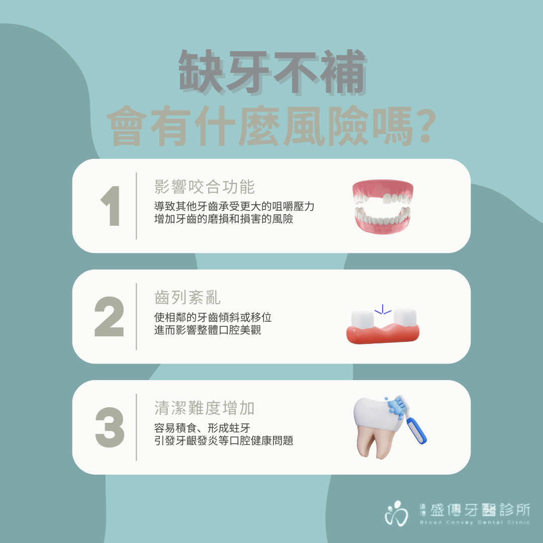 第二大臼齒拔掉一定要植牙嗎?拔牙多久是植牙最佳時間點? 4 第二大臼齒缺牙不補跟第一大臼齒缺牙不補會有什麼風險嗎?