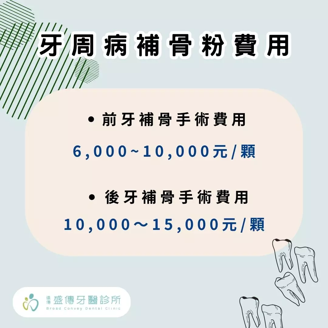 牙周病補骨粉費用多少?牙齒搖晃補骨粉有用嗎? 1 牙周病補骨粉費用