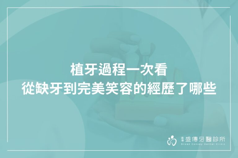 植牙過程一次看