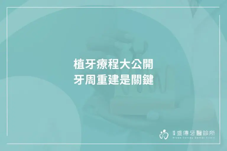 dental implant treatment