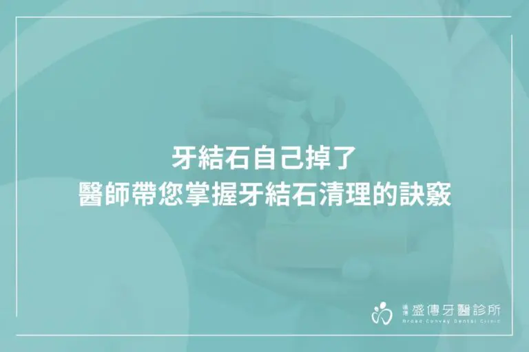 有牙結石怎麼辦?可以自行清除嗎?牙醫師帶您掌握預防牙結石關鍵,享受健康口腔 7 dental calculus fall out