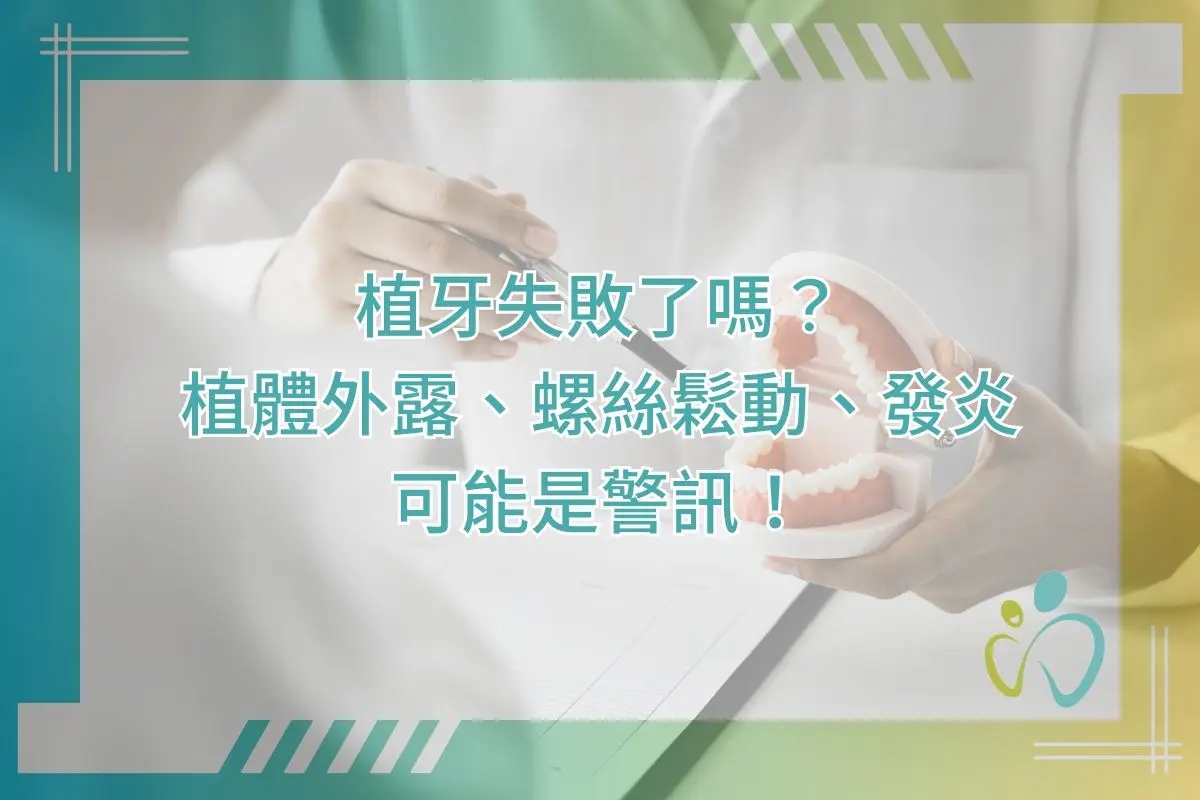 植牙失敗了嗎？植體外露、螺絲鬆動、發炎可能是警訊！
