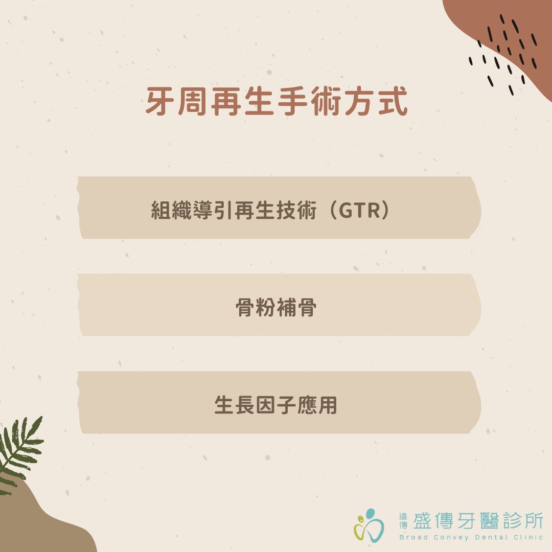 牙周再生手術是什麼?誰需要做牙周再生手術?費用、成功率一次看懂 1 牙周再生手術方式