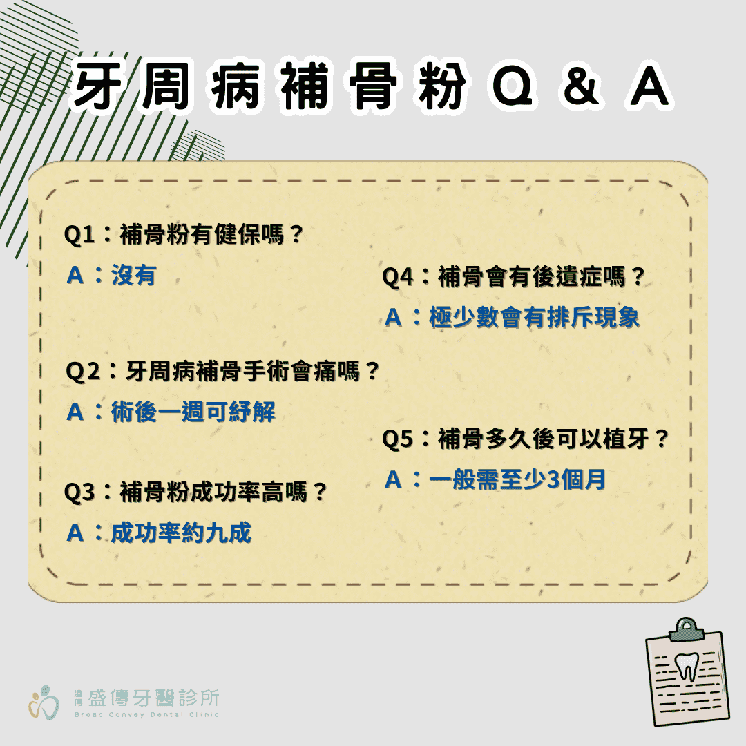 牙周病補骨粉費用多少?牙齒搖晃補骨粉有用嗎? 3 牙周病補骨粉QA