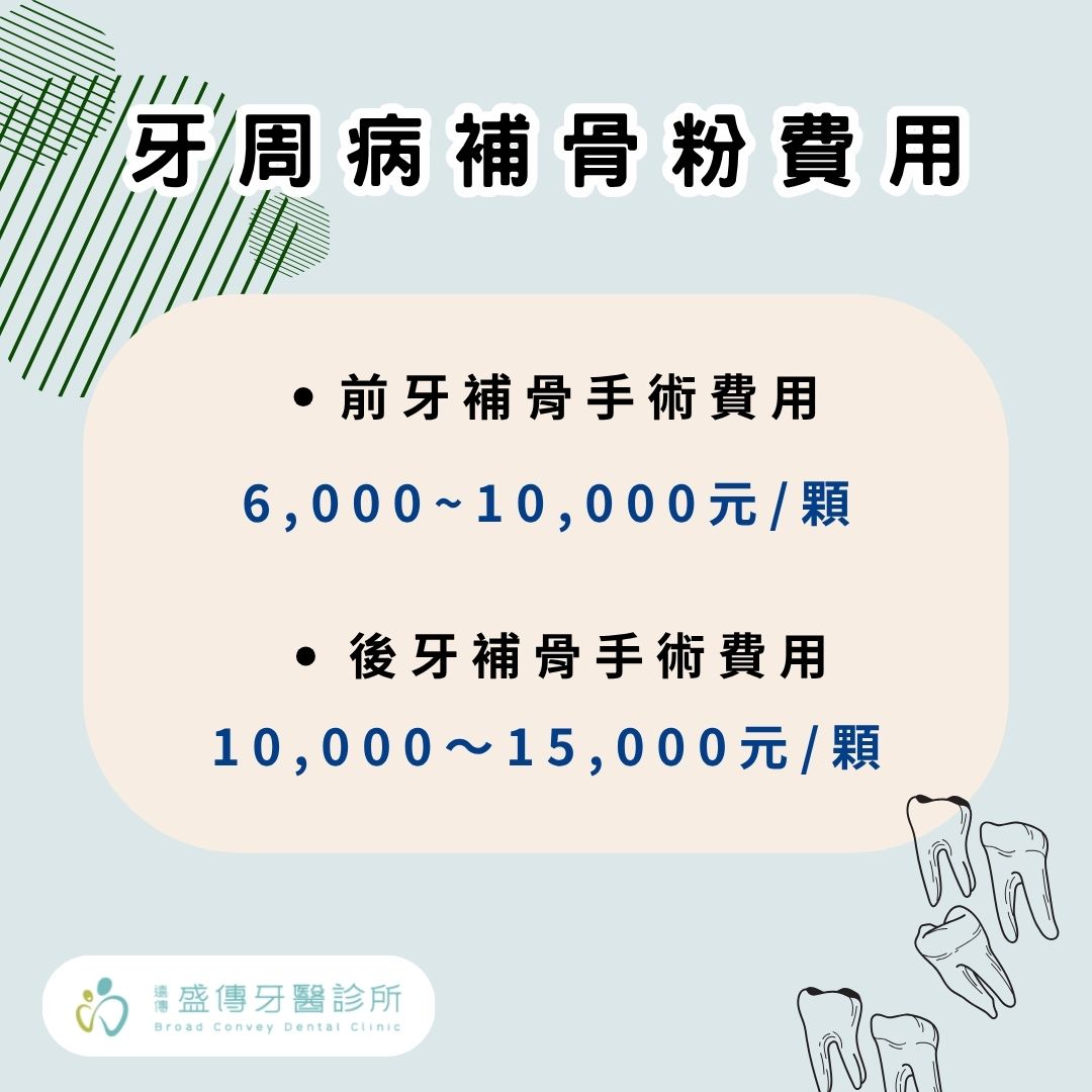 牙周病補骨粉費用多少?牙齒搖晃補骨粉有用嗎? 1 牙周病補骨粉費用