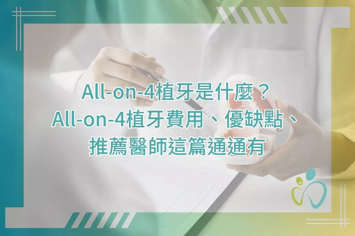 All-on-4植牙是什麼？All‑on‑4植牙費用、優缺點、推薦醫師這篇通通有