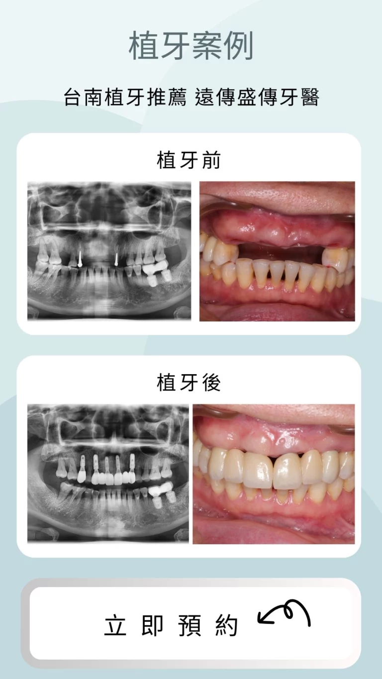 case-1