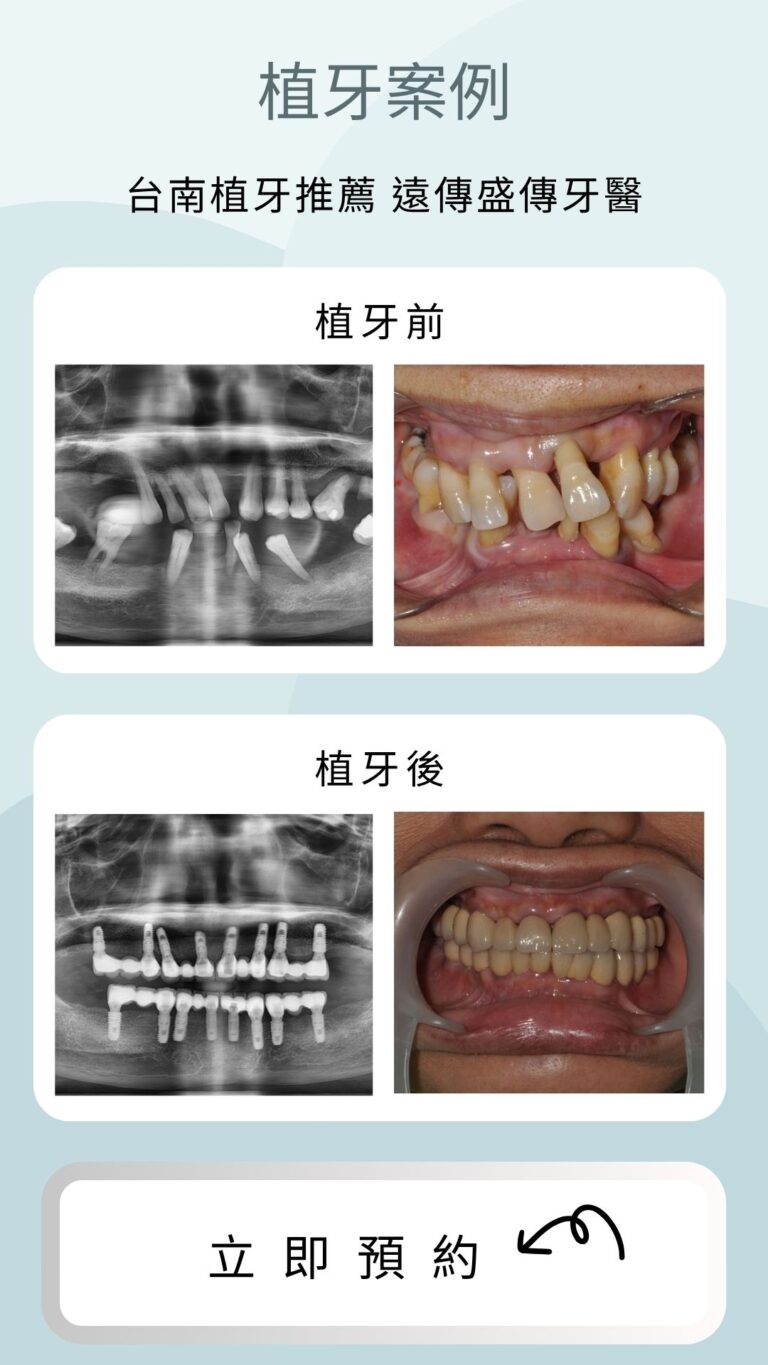 case-2