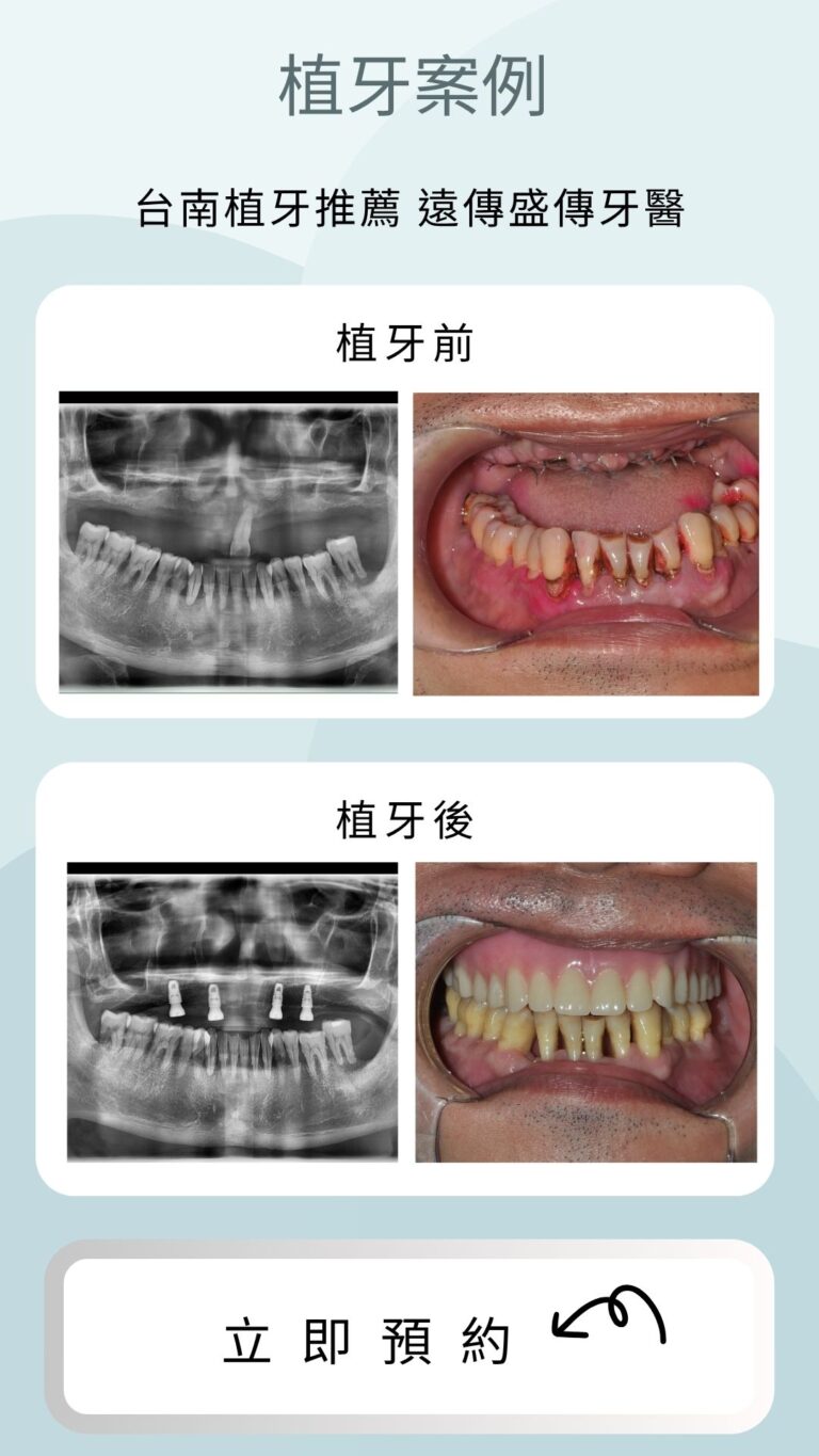 case-3