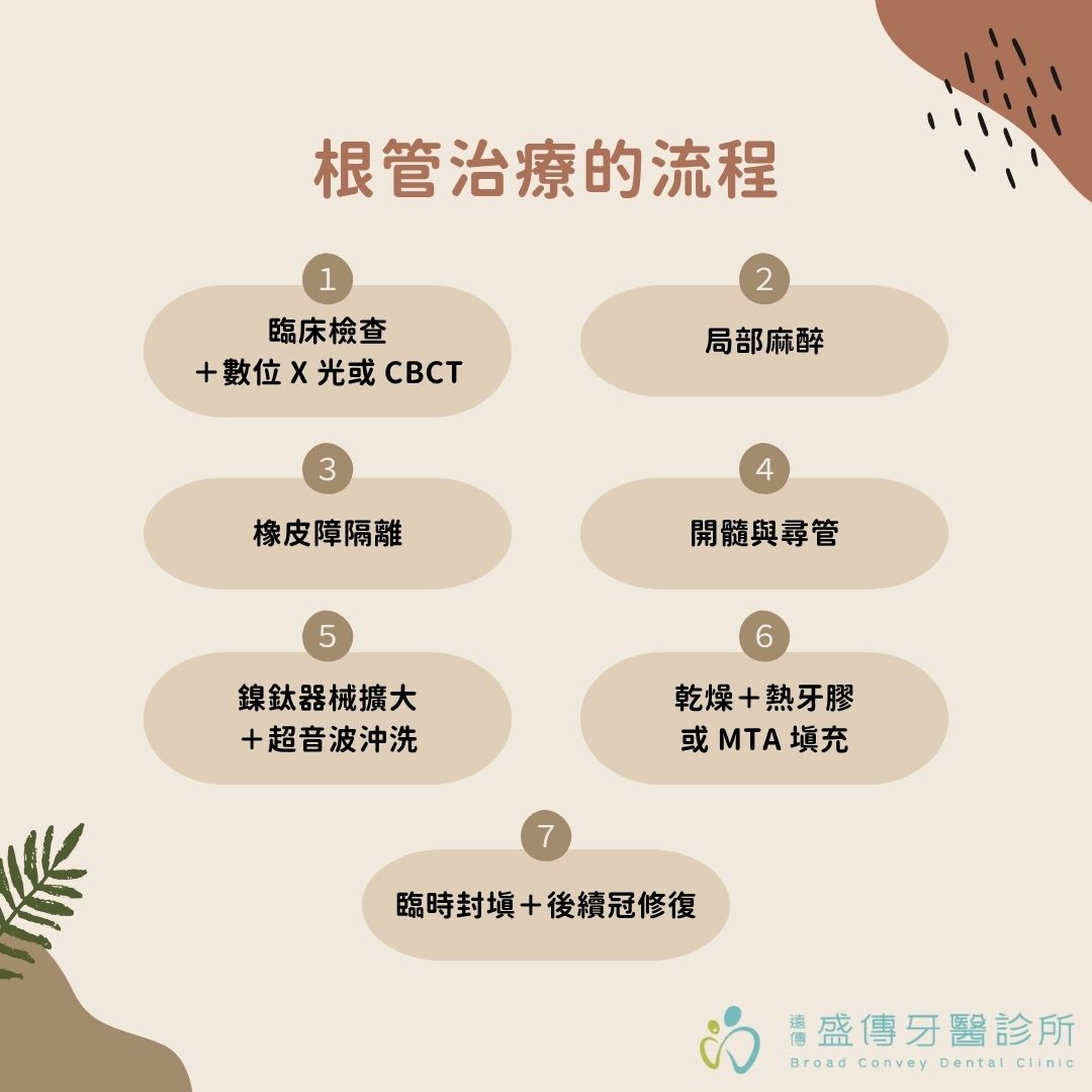 根管治療會痛嗎?用顯微根管就不會痛嗎?怕痛根管治療延誤就醫3大危害一次告訴你 1 根管治療的流程