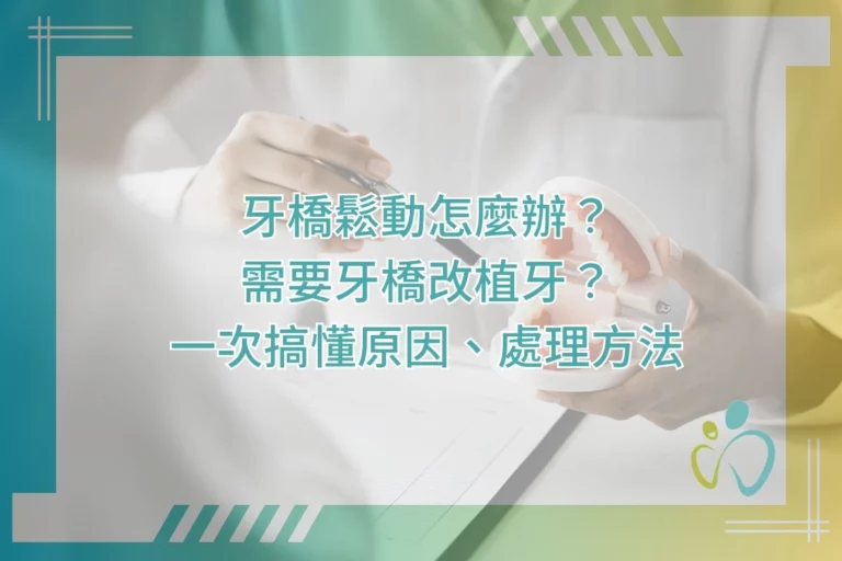 牙橋鬆動怎麼辦?需要牙橋改植牙?一次搞懂原因、處理方法 4 牙橋鬆動怎麼辦?需要牙橋改植牙?一次搞懂原因、處理方法