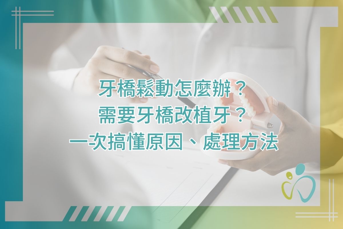 牙橋鬆動怎麼辦？需要牙橋改植牙？一次搞懂原因、處理方法