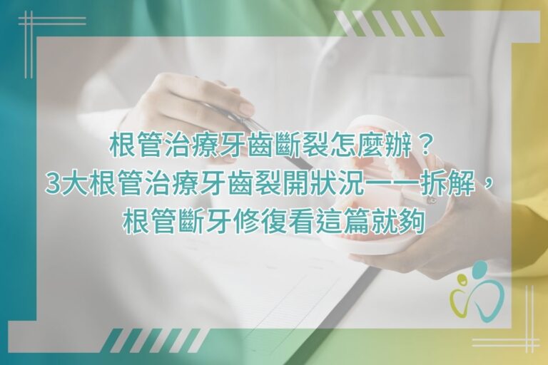 根管治療牙齒斷裂怎麼辦？3大根管治療牙齒裂開狀況一一拆解，根管斷牙修復看這篇就夠