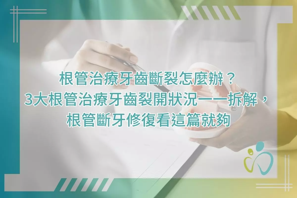 根管治療牙齒斷裂怎麼辦?3大根管治療牙齒裂開狀況一一拆解,根管斷牙修復看這篇就夠
