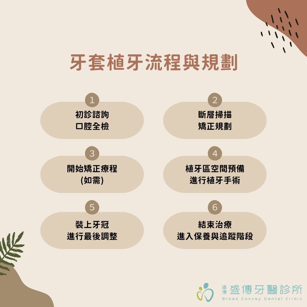 牙套植牙可以一起做嗎?到底應該先植牙還是先矯正?戴牙套跟植牙搭配方式全指南 3 牙套植牙流程與規劃