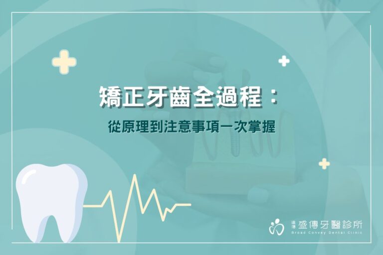 矯正牙齒全過程：從原理到注意事項一次掌握