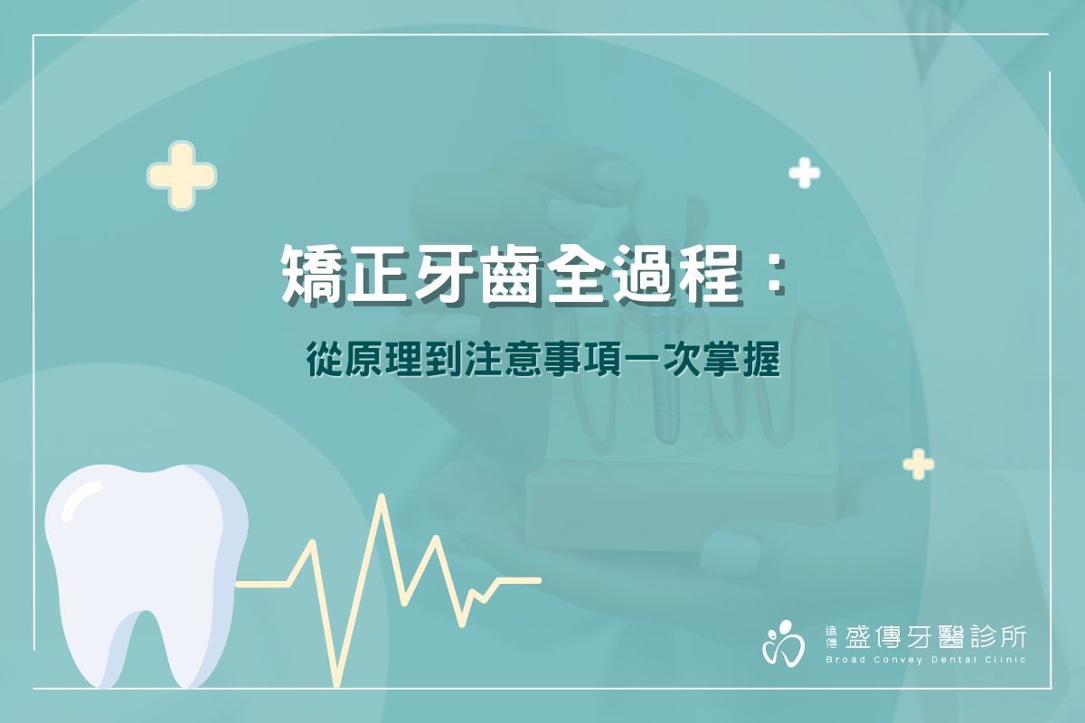 矯正牙齒全過程：從原理到注意事項一次掌握