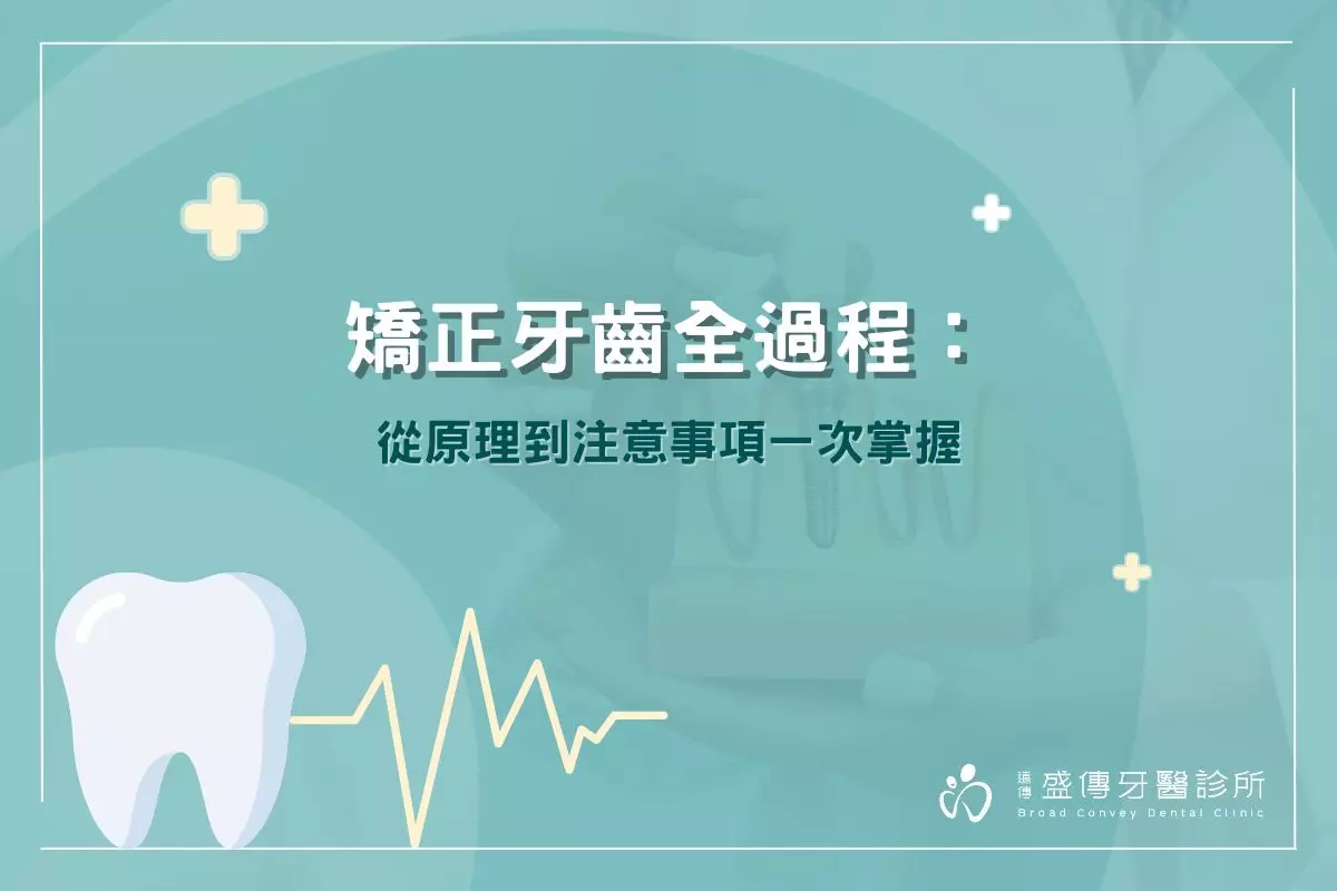 矯正牙齒全過程：從原理到注意事項一次掌握