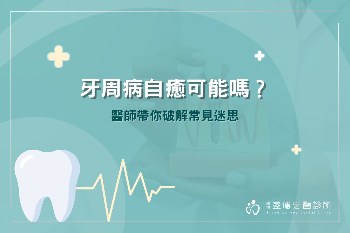 牙周病自癒可能嗎？醫師帶你破解常見迷思