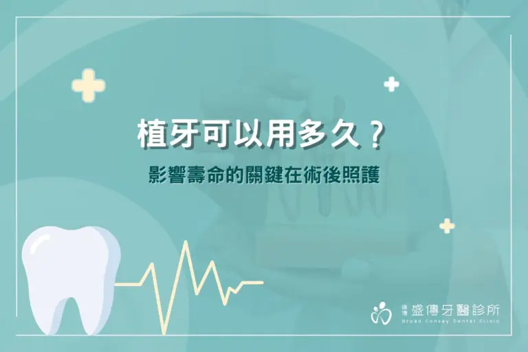 植牙可以用多久?影響壽命的關鍵在術後照護 9 植牙可以用多久?影響壽命的關鍵在術後照護
