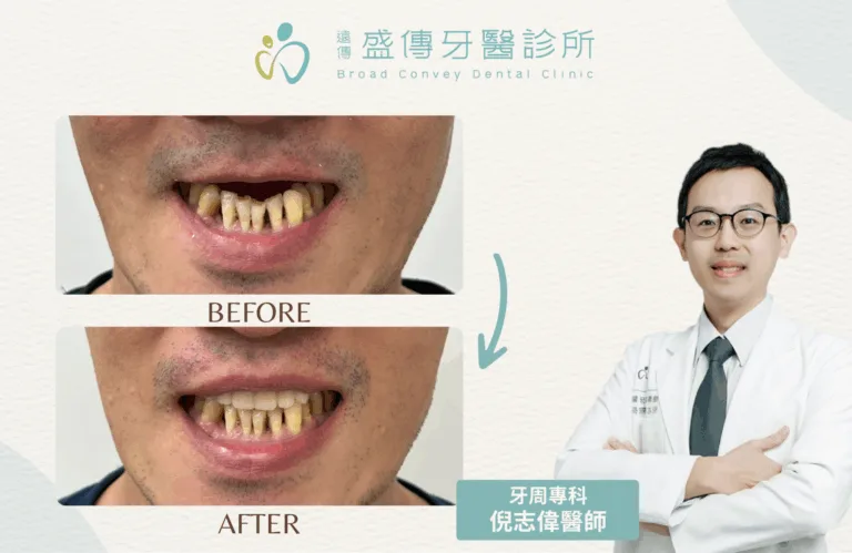 案例照 10