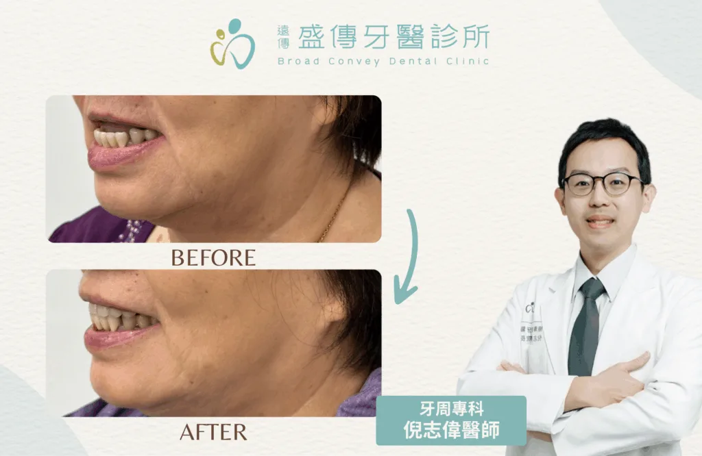 案例照