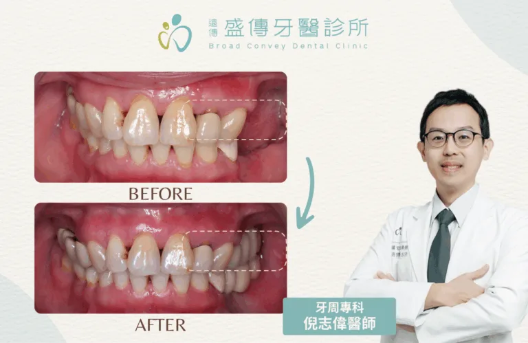 案例照 2