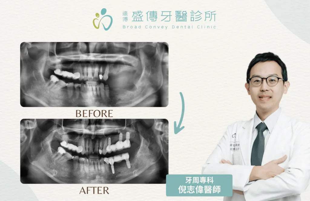 案例照 3