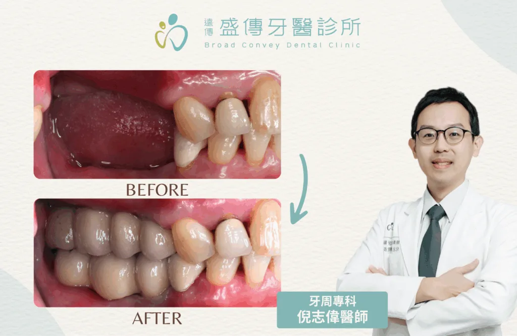 案例照 4