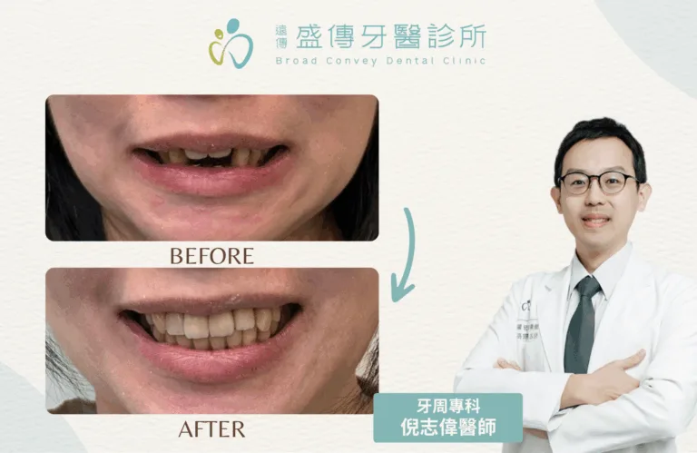 案例照 5