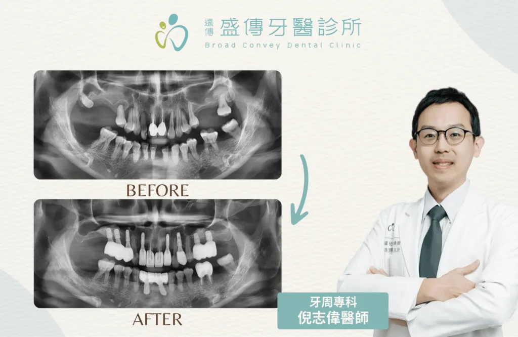 案例照 6