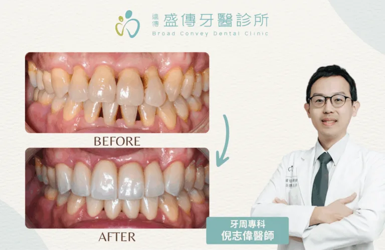 案例照 8