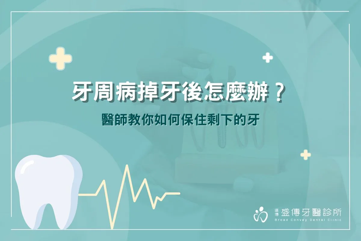 牙周病掉牙後怎麼辦？醫師教你如何保住剩下的牙