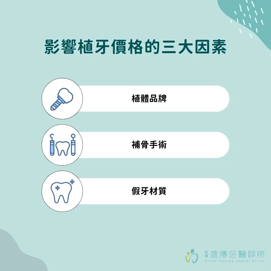 影響植牙價格的三大因素