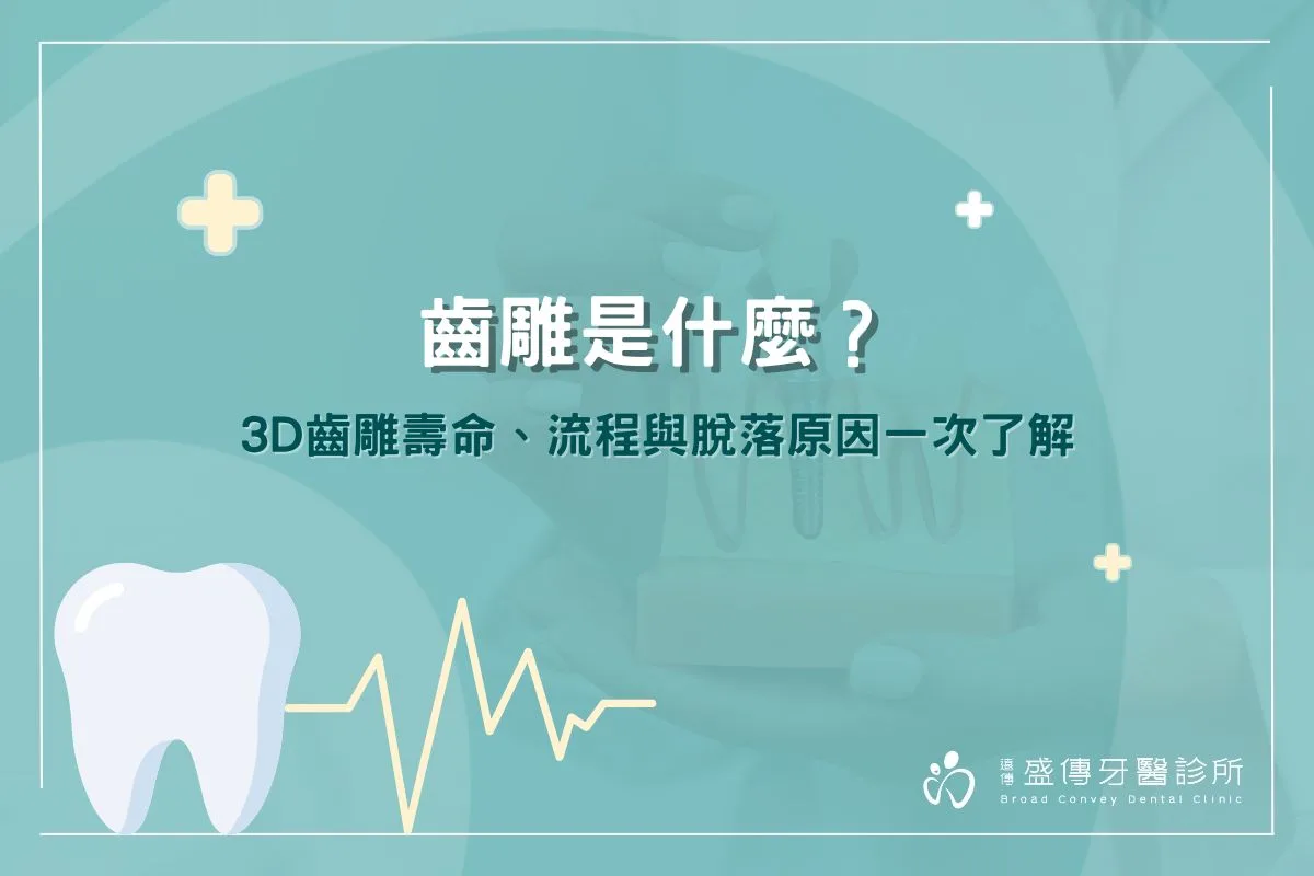 齒雕是什麼？3D齒雕壽命、流程與脫落原因一次了解