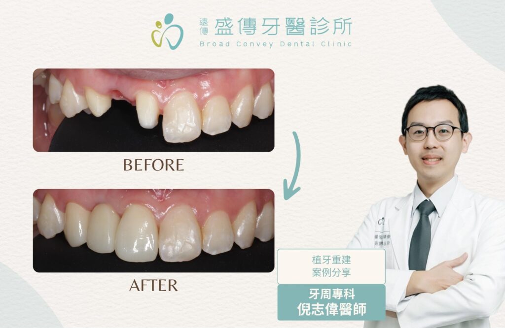 case 17 01