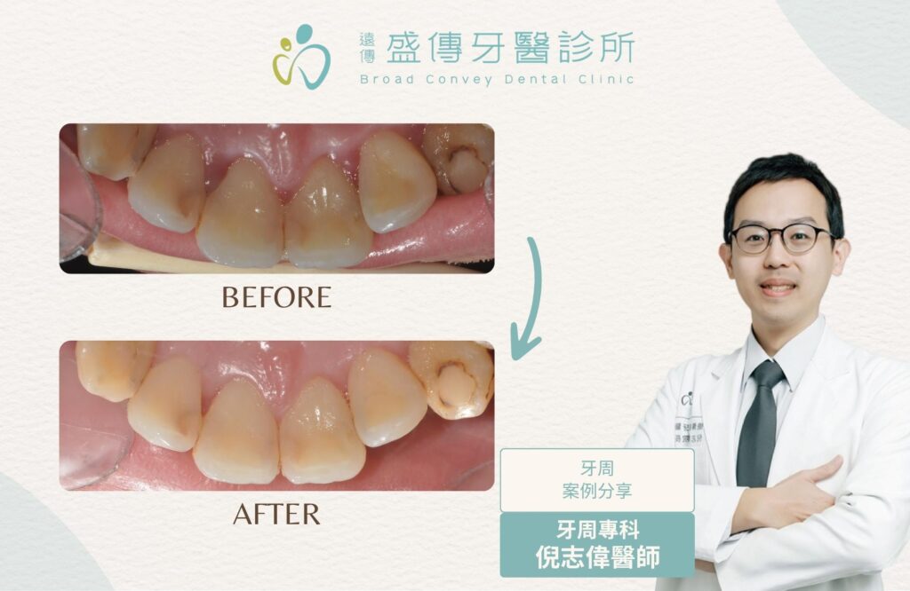 case 25 02