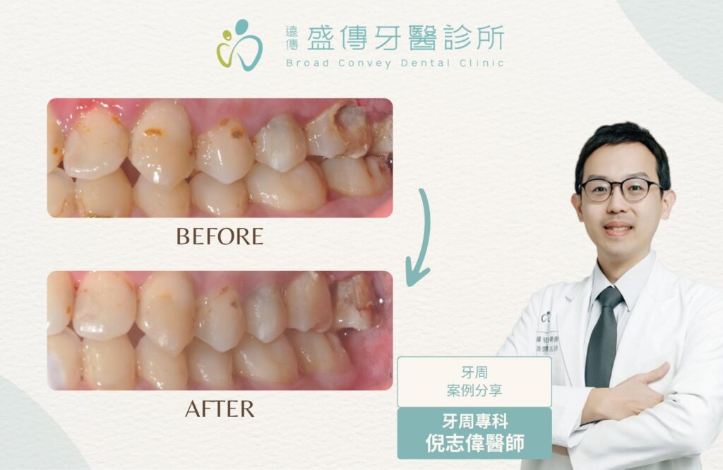 case 25 03