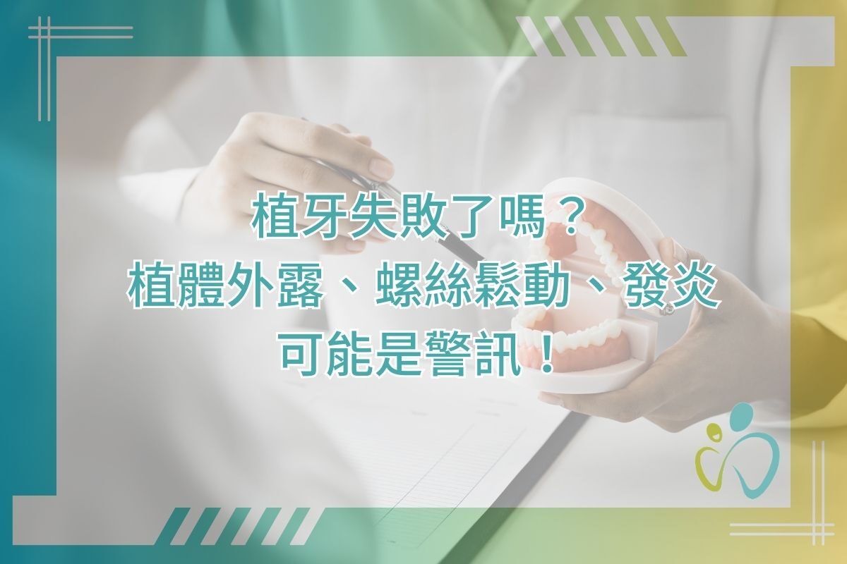 植牙失敗了嗎？植體外露、螺絲鬆動、發炎可能是警訊！